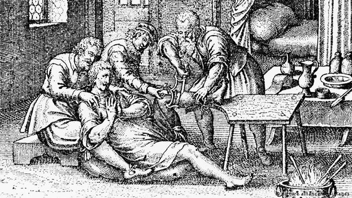 Иллюстрация 1633 года к изданию собрания трудов Вильгельма Фабри во Франкфурте-на-Майне