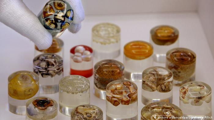 Желчные камни из коллекции берлинского Музея истории медицины